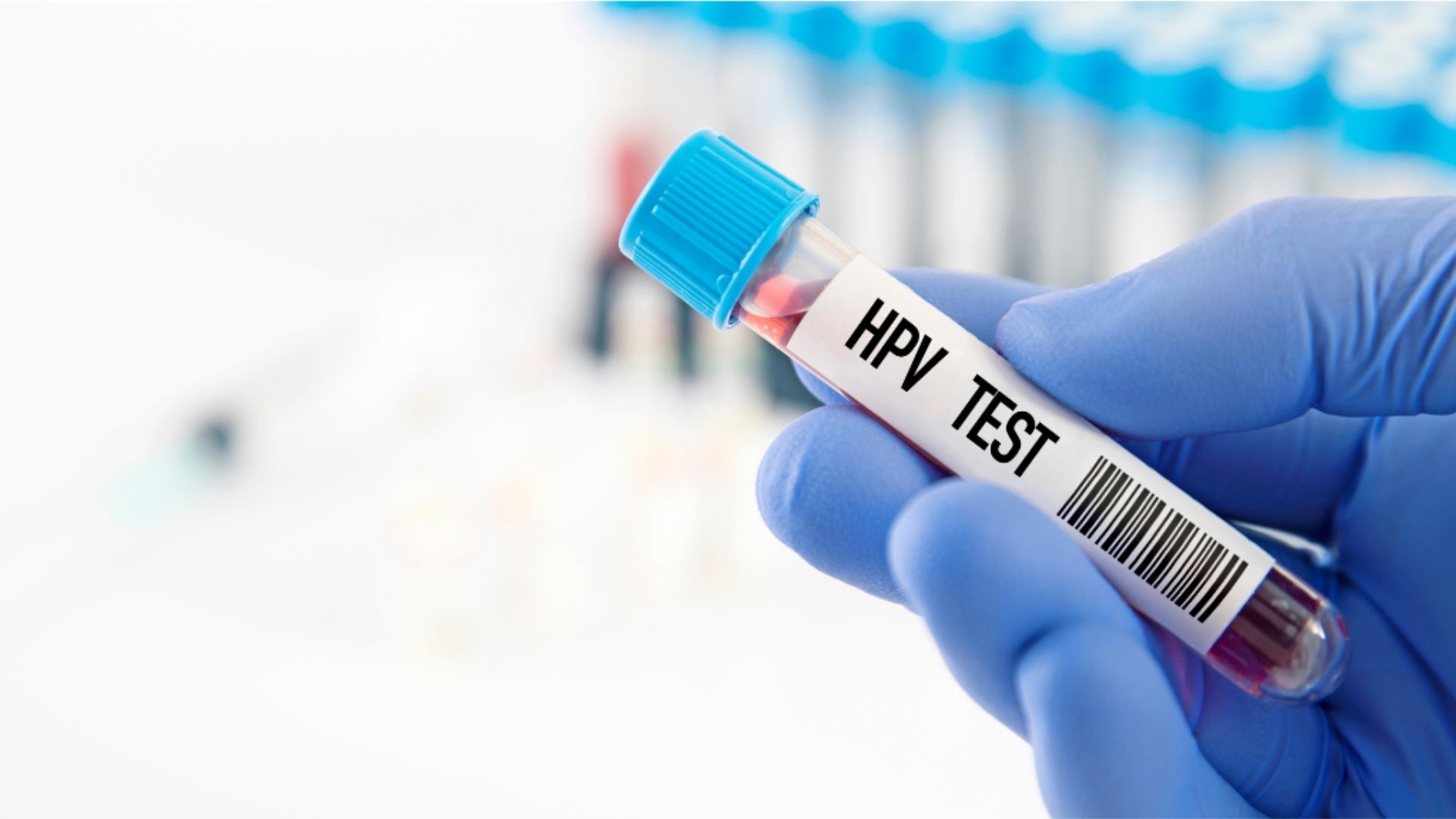 HPV Testi